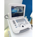 alta qualidade echo LED disply scanner de diagnóstico ultrassônico portátil